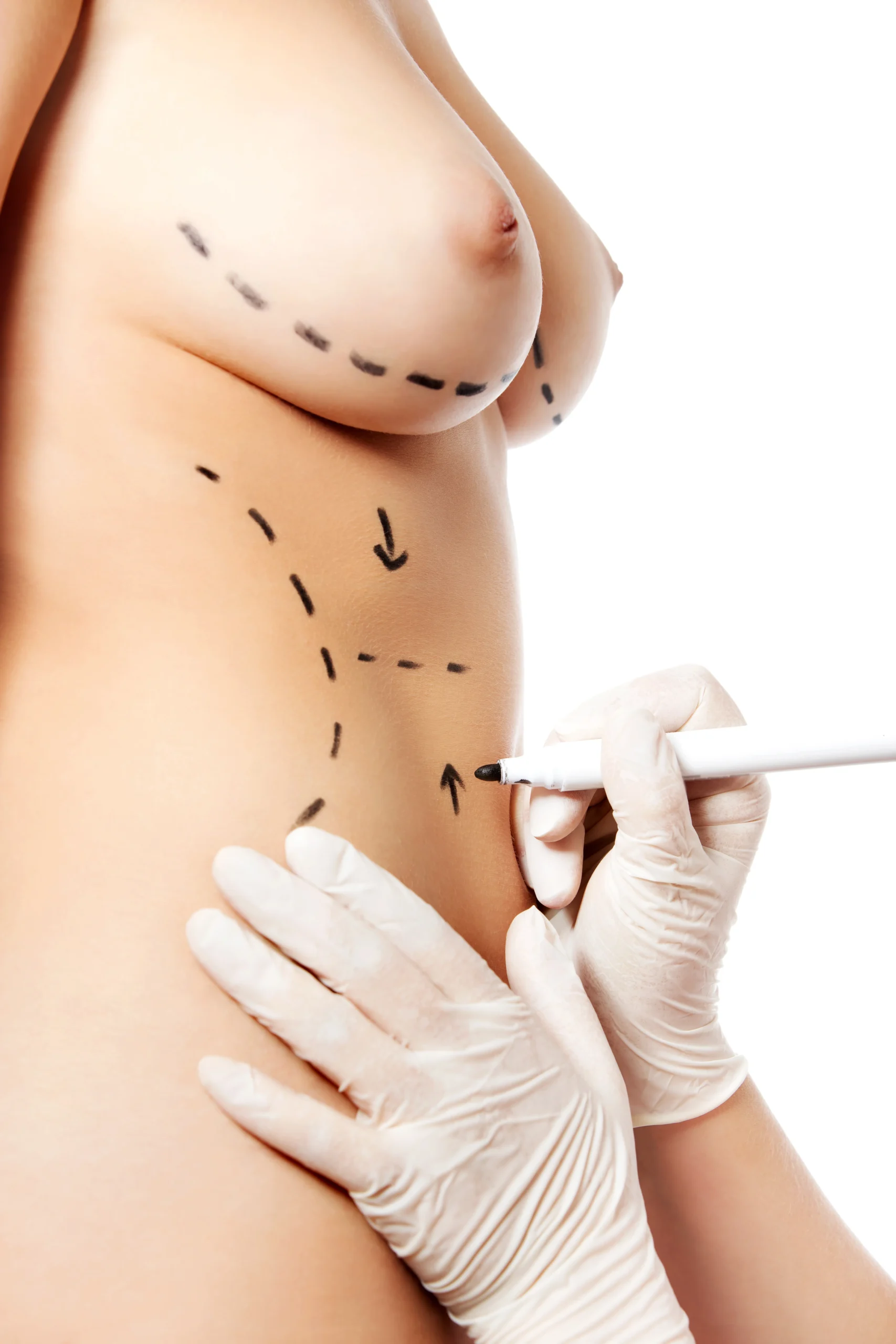 top 8 aesthetic treatments in Istanbul